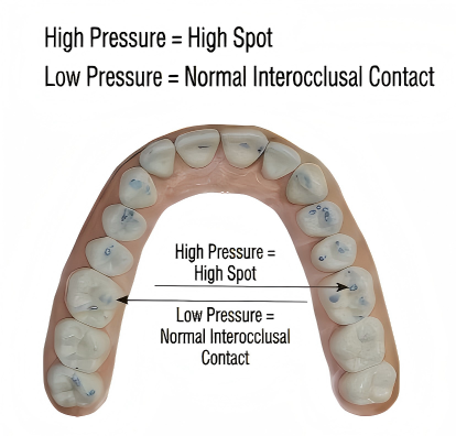 Bausch 100µm Articulating Paper