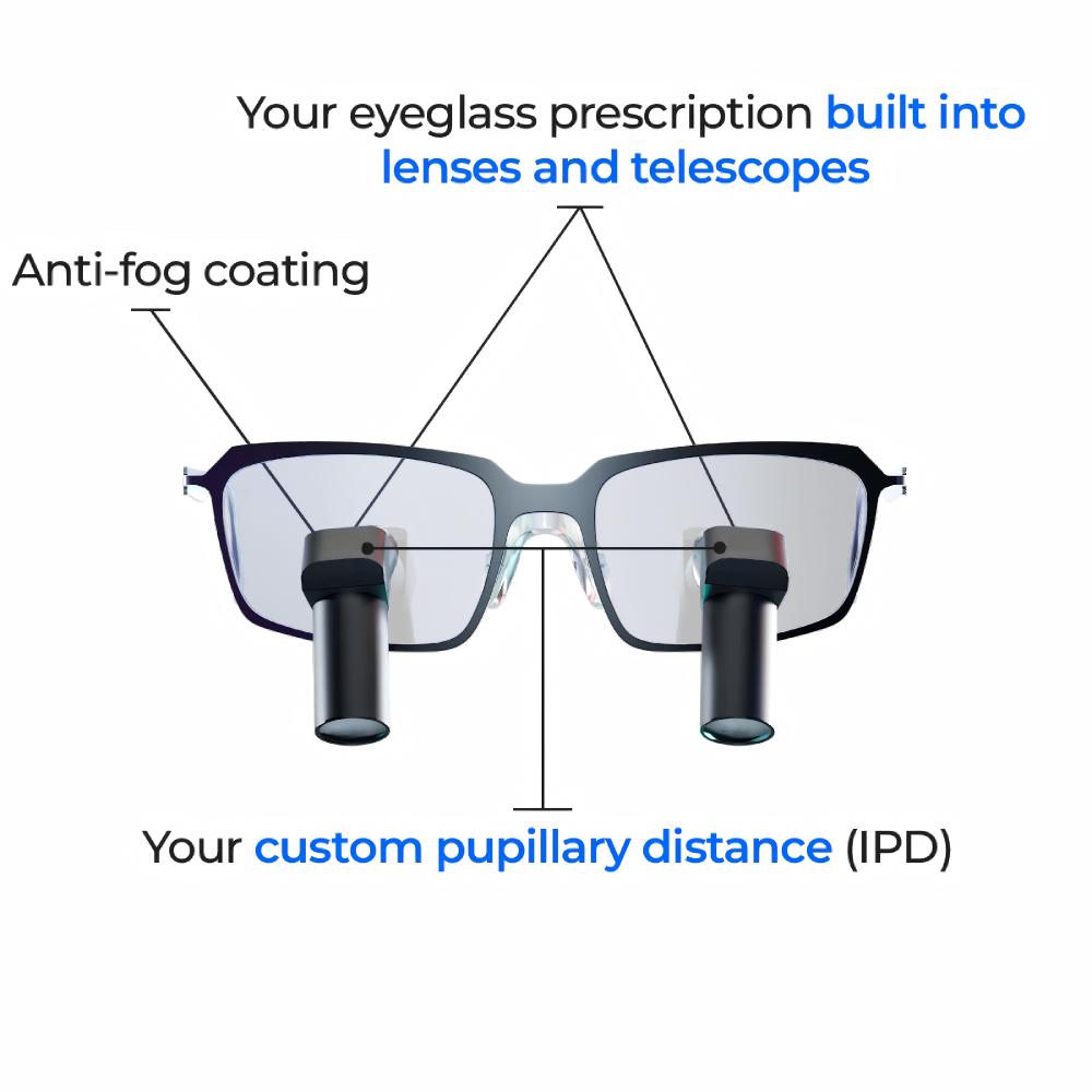 A detailed front-view diagram of Oradenix custom Ergo TTL dental loupes. The image highlights key bespoke features, including eyeglass prescriptions built directly into both the carrier lenses and telescopes, an anti-fog coating, and precise customization for the user's pupillary distance (IPD).